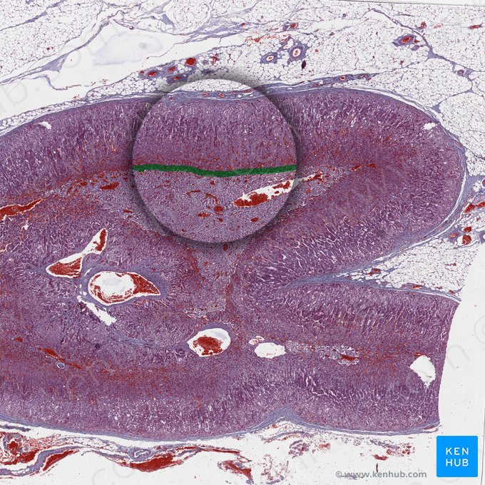 Unión corticomedular (Junctio corticomedullaris); Imagen: 