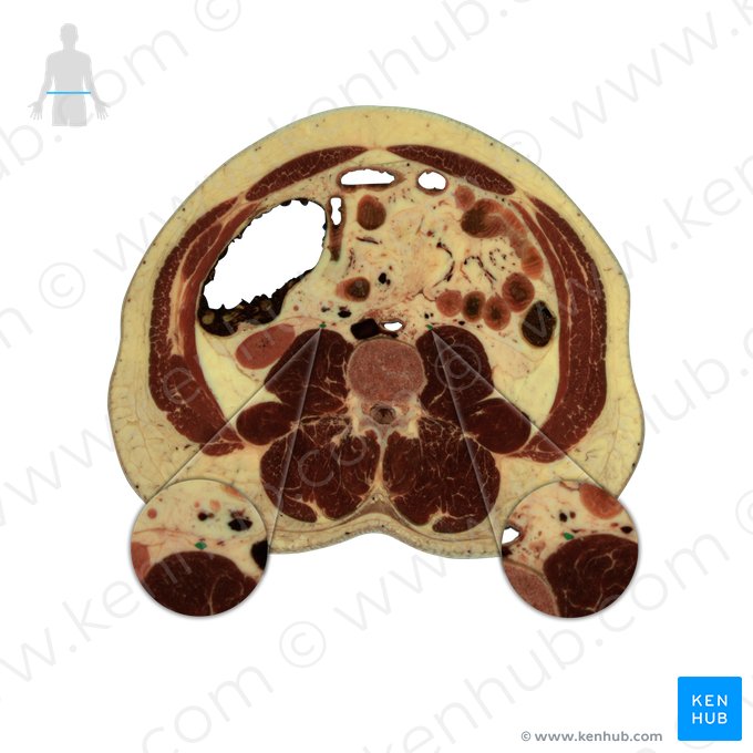 Ureter; Image: National Library of Medicine