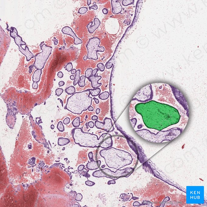 Vellosidades coriónicas (Chorion frondosum); Imagen: 