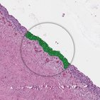 Urothel