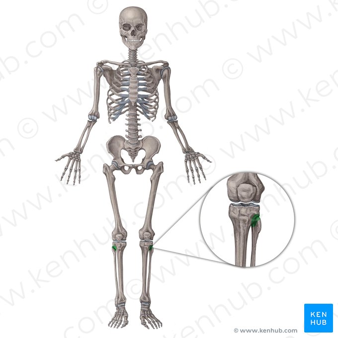 Superior tibiofibular joint (Articulatio tibiofibularis superior); Image: Irina Münstermann