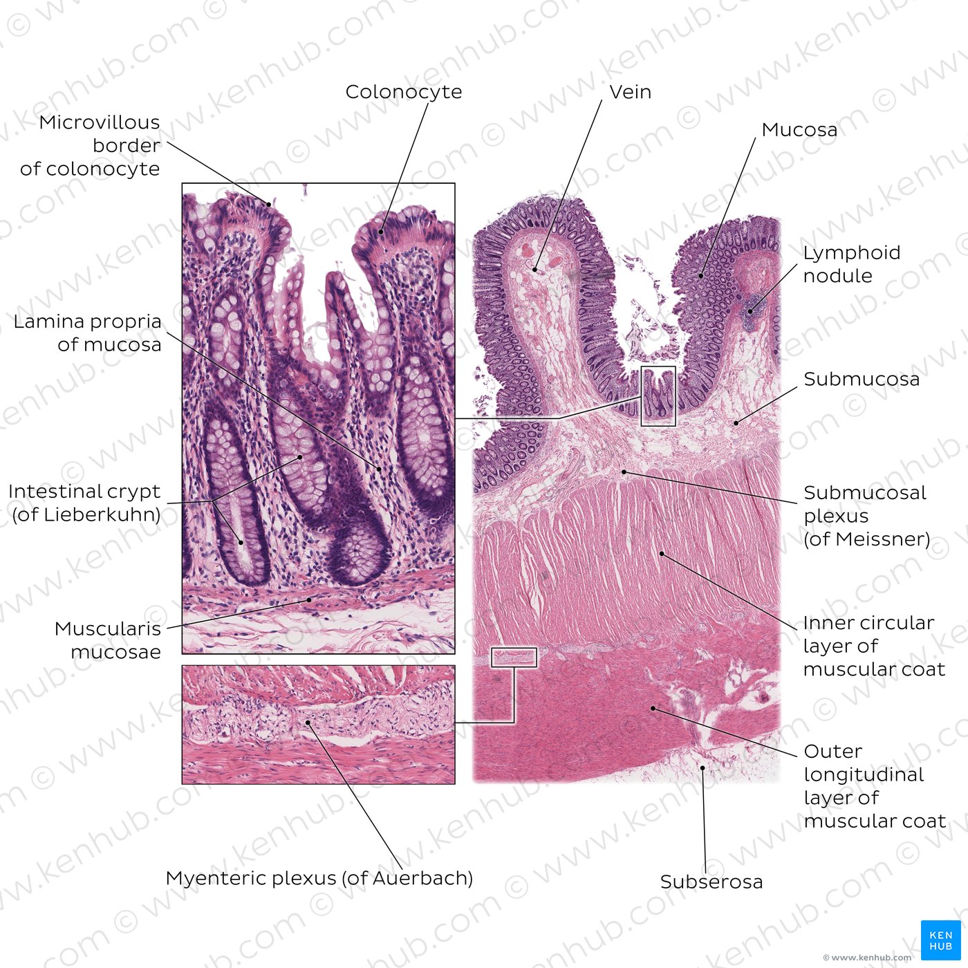 Longitudinal section of colon
