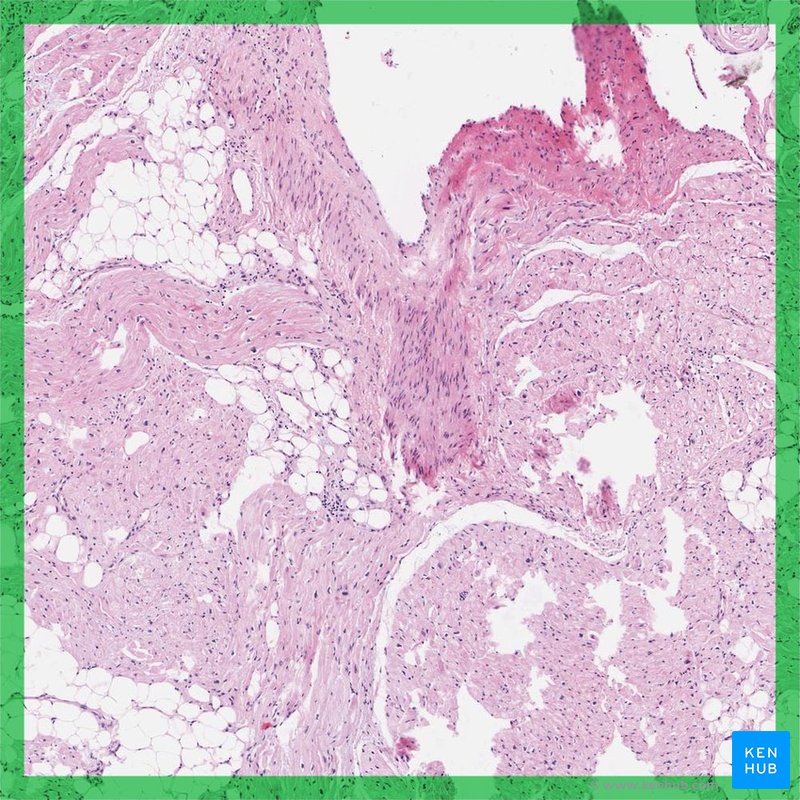 Heart conductive system - histological slide