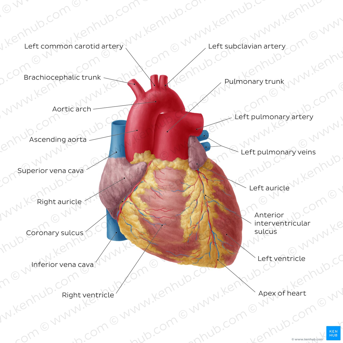 Clogged Artery Model, English-Spanish