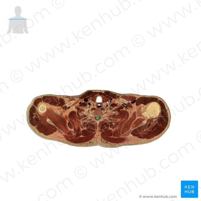 Spinal cord (Medulla spinalis); Image: National Library of Medicine