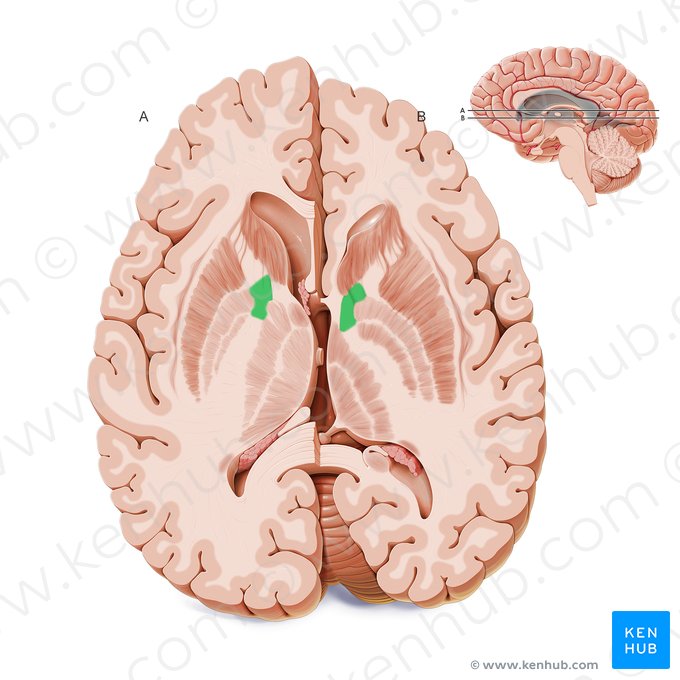 Rodilla de la cápsula interna (Genu capsulae internae); Imagen: Paul Kim