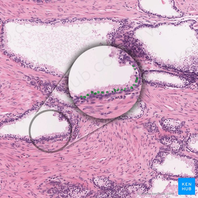 Secretory cells; Image: 