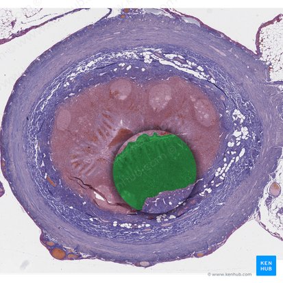Tunica mucosa (Schleimhaut); Bild: 