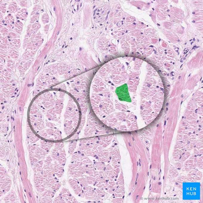 Muscle fiber (Myofibra); Image: 