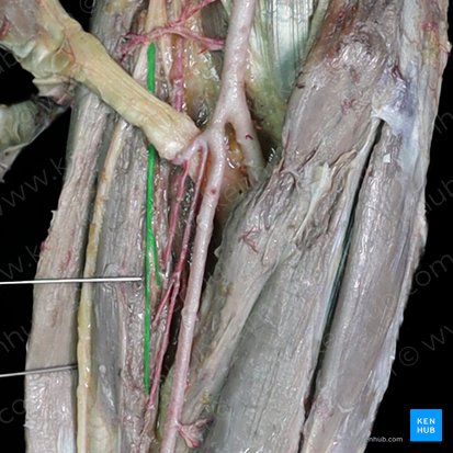 Muscular branches of radial nerve (Rami musculares nervi radialis); Image: 