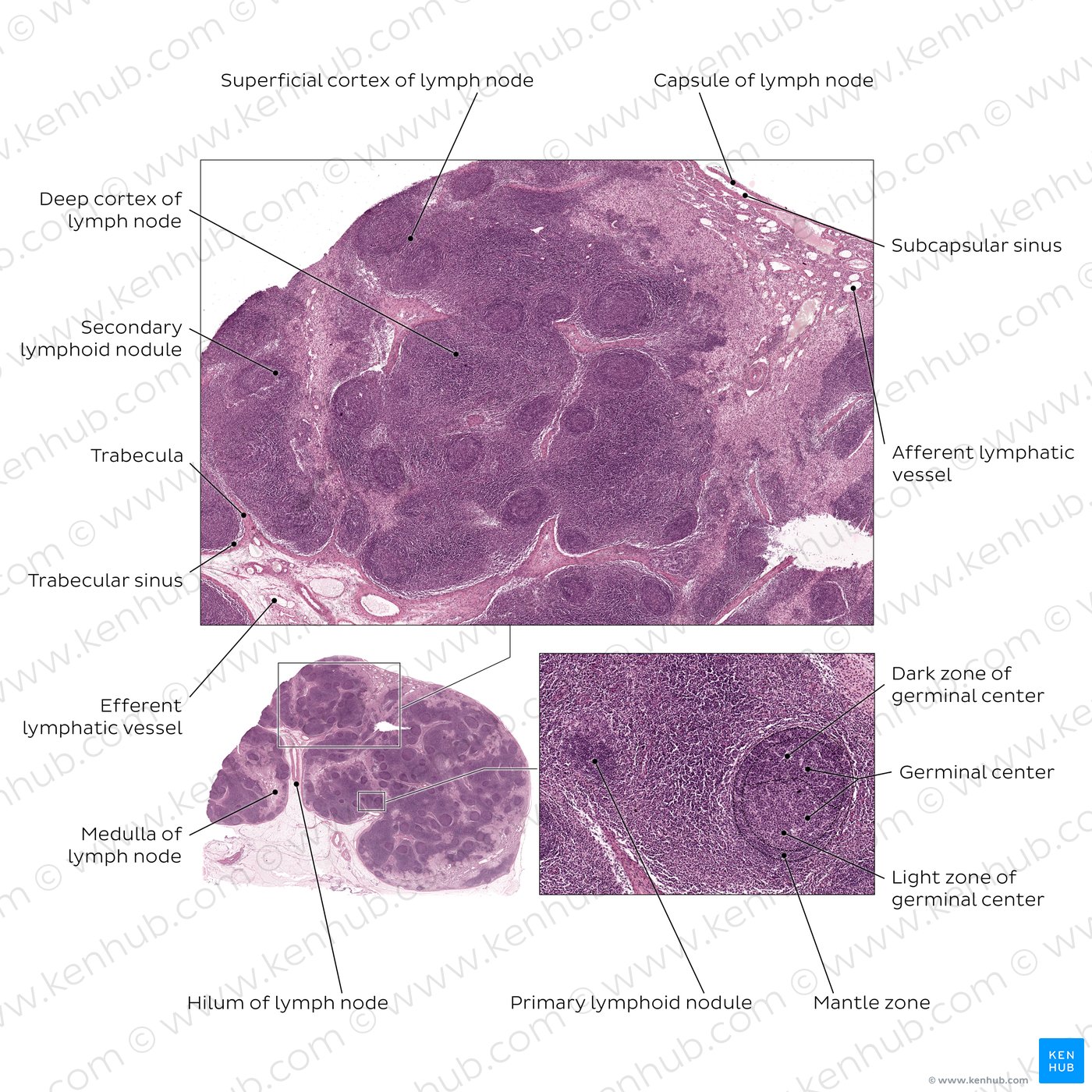 Active lymph node. Stain: hematoxylin and eosin. Medium magnification.