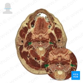 Artéria carótida interna (Arteria carotis interna); Imagem: National Library of Medicine