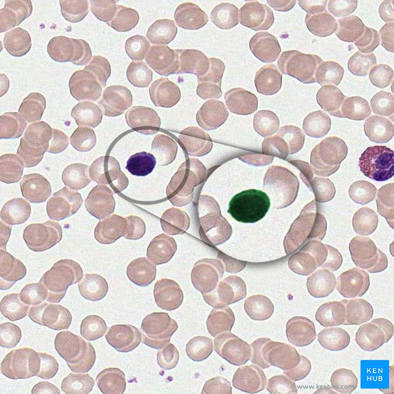 Lymphocytes - histological slide