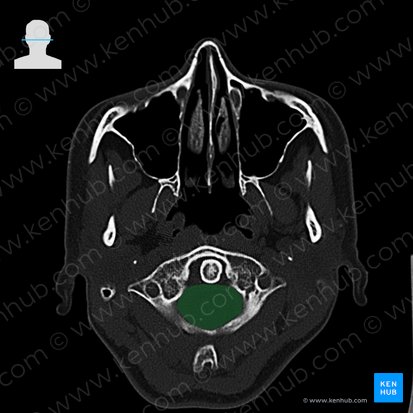 Vertebral canal (Canalis vertebralis); Image: 