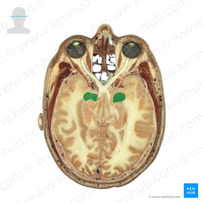 Amygdaloid body (Corpus amygdaloideum); Image: National Library of Medicine