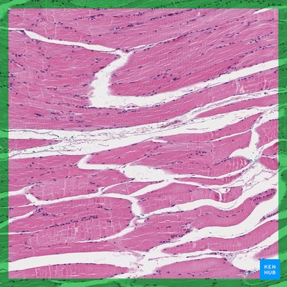 Textus muscularis skeletalis (Skelettmuskel); Bild: 