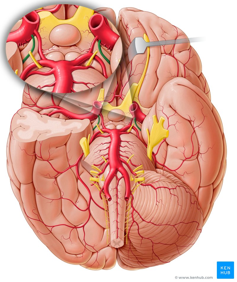Anterior choroidal artery Anatomy, branches, supply Kenhub