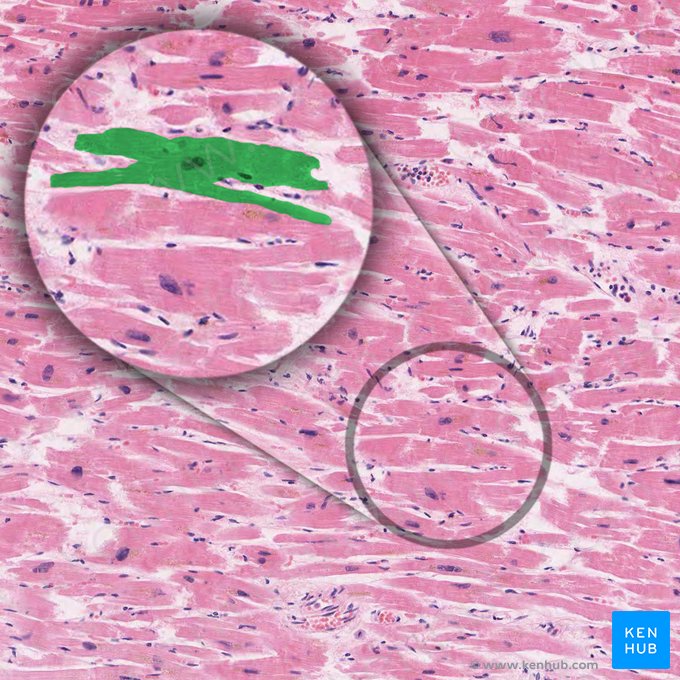 Cardiomyocytus ramosus (Verzweigte Herzmuskelzelle); Bild: 