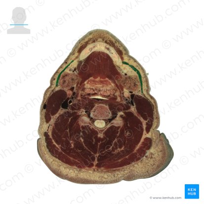 Platisma (Musculus platysma); Imagem: National Library of Medicine