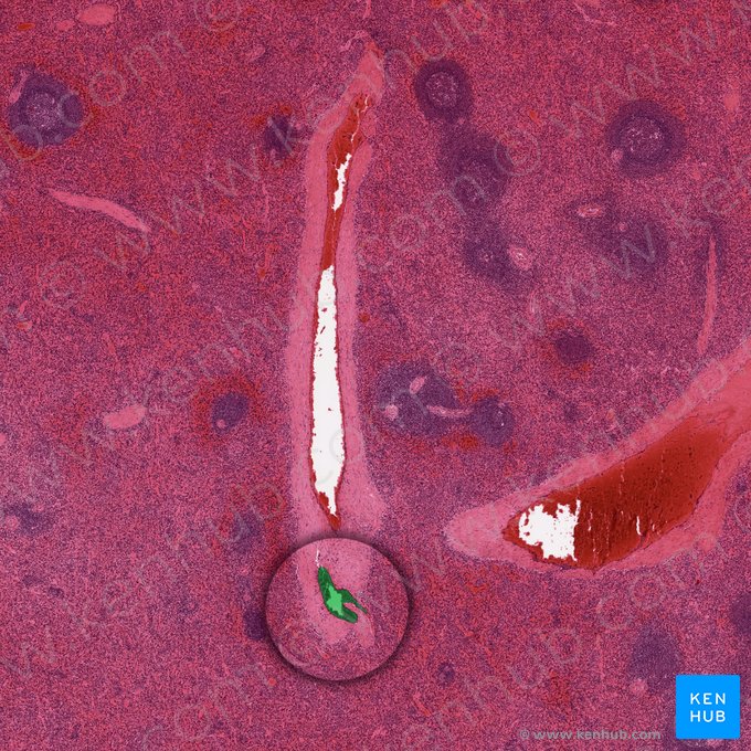 Artéria trabecular do baço (Arteria trabecularis splenis); Imagem: 
