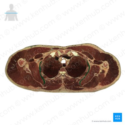 Serratus anterior muscle (Musculus serratus anterior); Image: National Library of Medicine