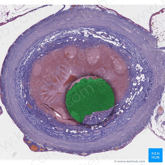 Mucosa (Tunica mucosa); Imagen: 