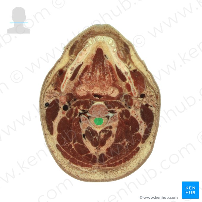 Medula espinal (Medulla spinalis); Imagem: National Library of Medicine