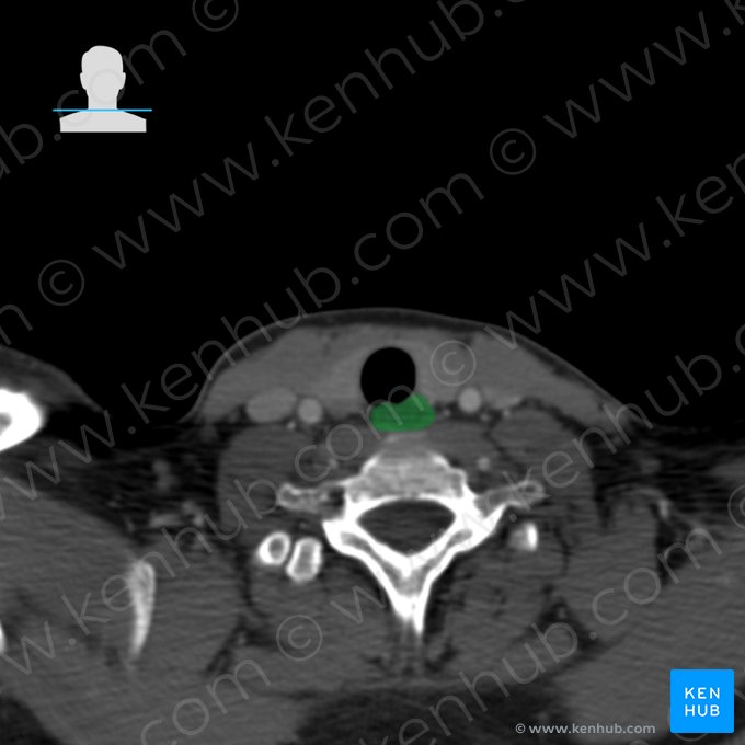 Esôfago (Oesophagus); Imagem: 