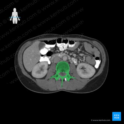 Vertebra L3; Image: 