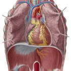 Aterosclerosis