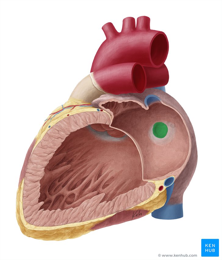 Valve of foramen ovale - lateral-left view