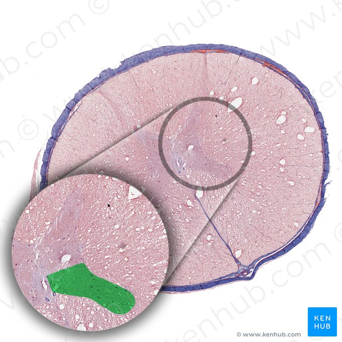 Cornu anterius medullae spinalis (Vorderhorn des Rückenmarks); Bild: 