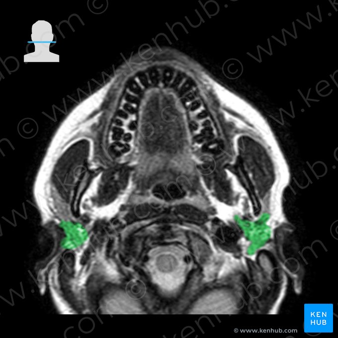 Glândula parótida (Glandula parotidea); Imagem: 