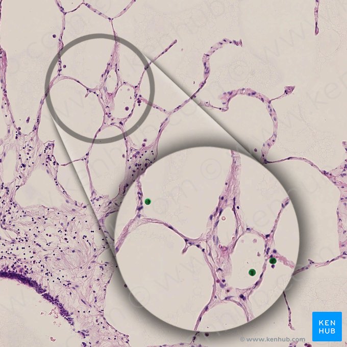 Macrófagos alveolares (Macrophagocytus alveolaris); Imagen: 