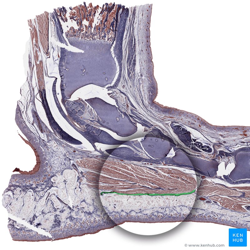 Plantar fascia (histological slide)