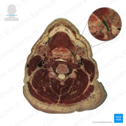 Músculo estilohioideo (Musculus stylohyoideus); Imagen: National Library of Medicine
