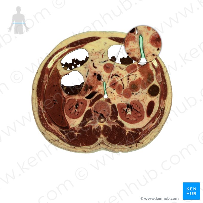 Arteria mesenterica superior (Obere Eingeweidearterie); Bild: National Library of Medicine