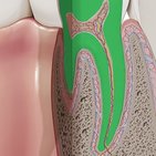 Deciduous teeth