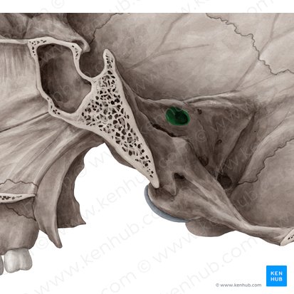 Internal acoustic meatus (Meatus acusticus internus); Image: Yousun Koh