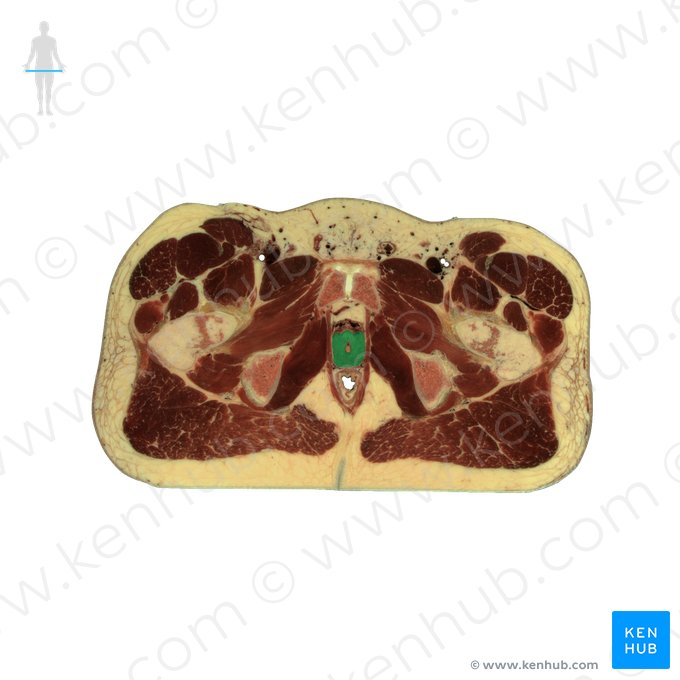 Prostate (Prostata); Image: National Library of Medicine