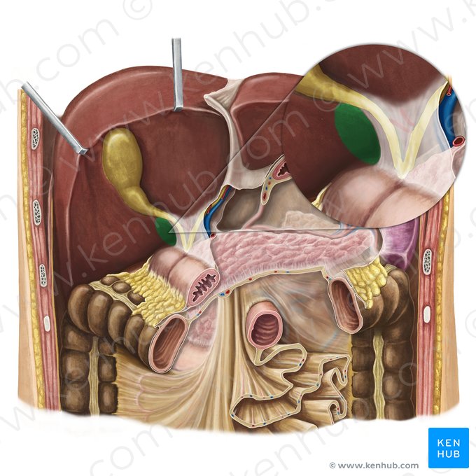 Omental foramen (Foramen omentale); Image: Irina Münstermann