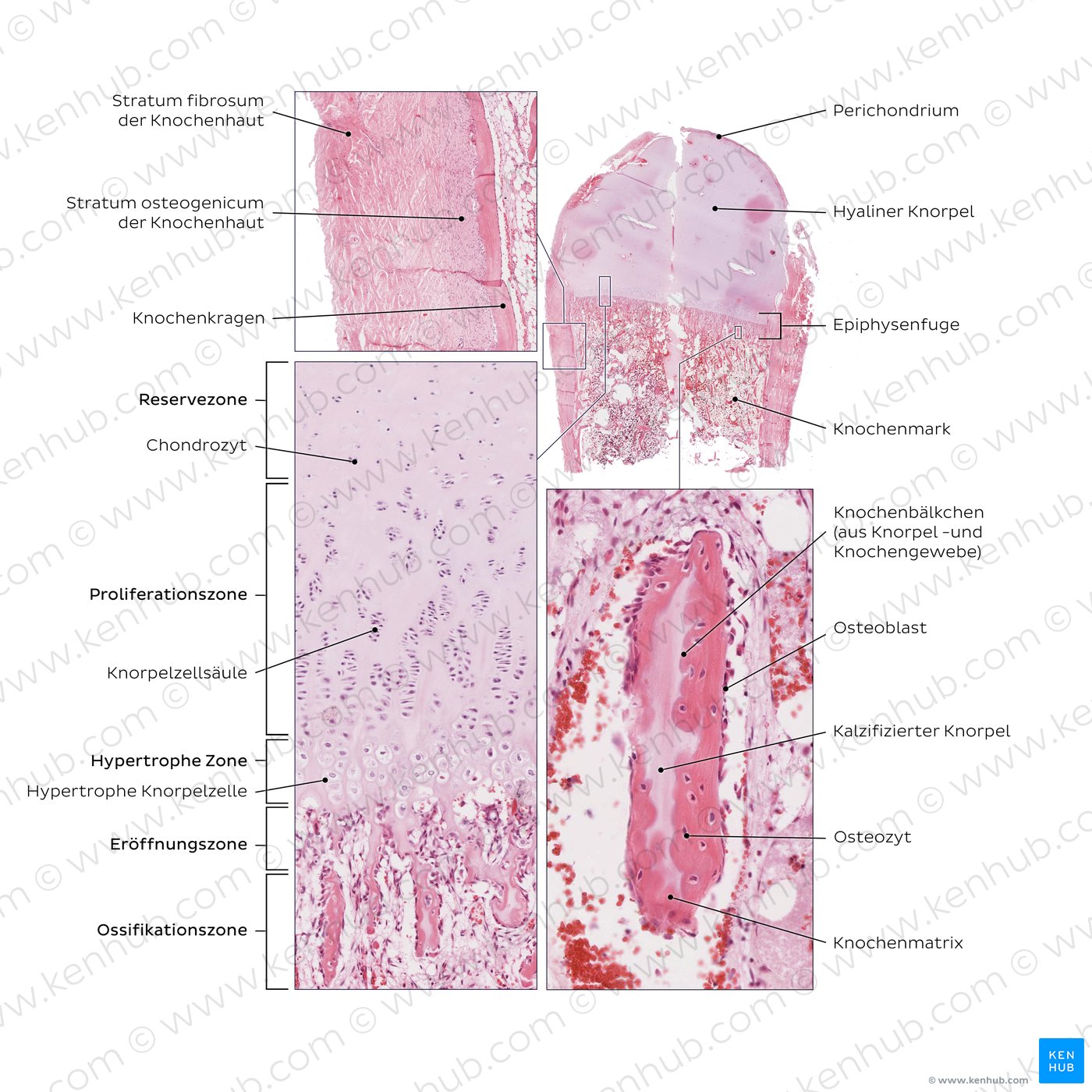 Enchondrale und perichondrale Knochenentwicklung (Färbung: Hämatoxylin-Eosin)