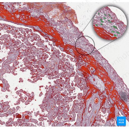 Decidual cells; Image: 