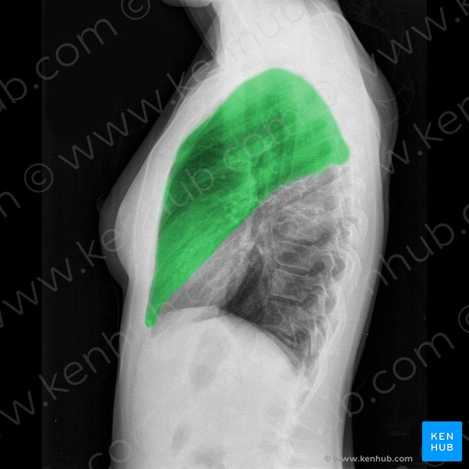 Lobo superior do pulmão esquerdo (Lobus superior pulmonis sinistri); Imagem: 