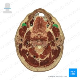 Buccal fat pad (Corpus adiposum buccae); Image: National Library of Medicine