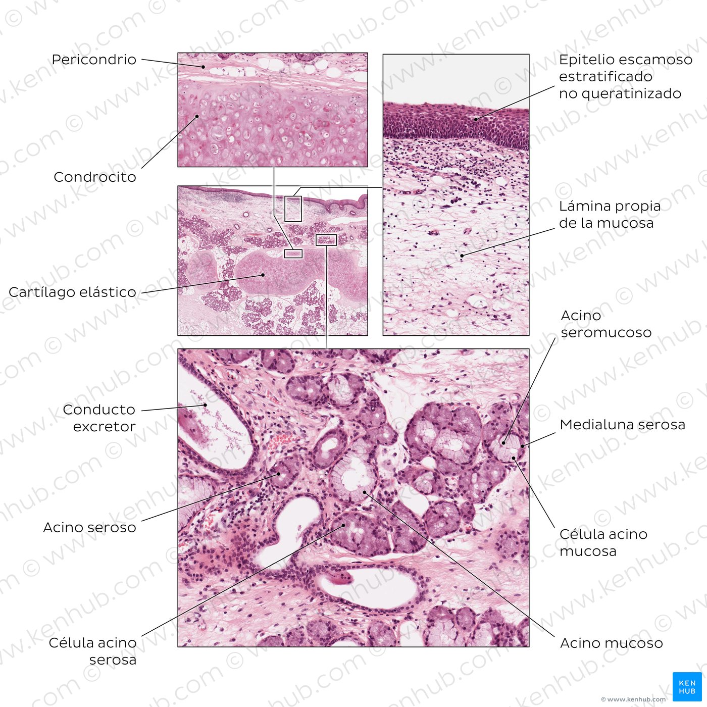 Epiglotis