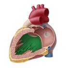 Interventricular septum