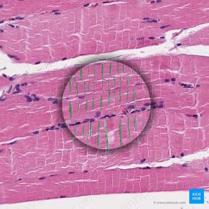 Z disc (Linea Z); Image: 