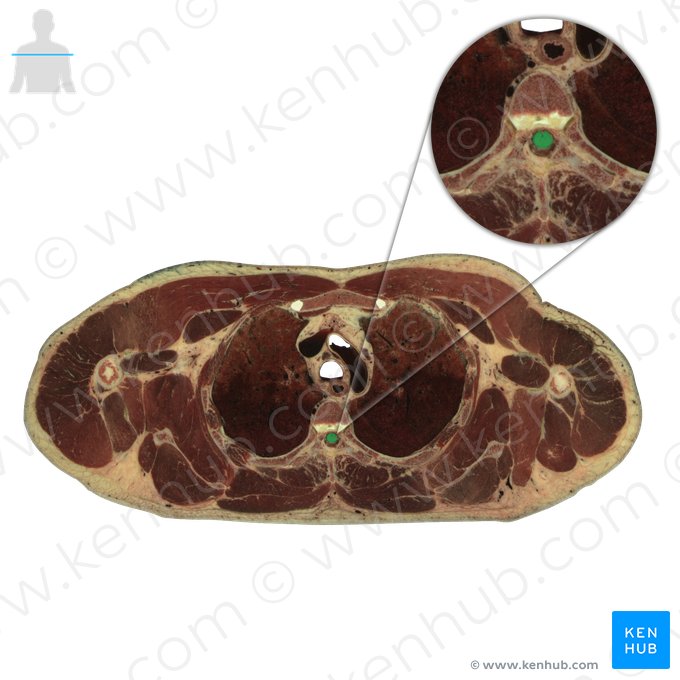 Spinal cord (Medulla spinalis); Image: National Library of Medicine