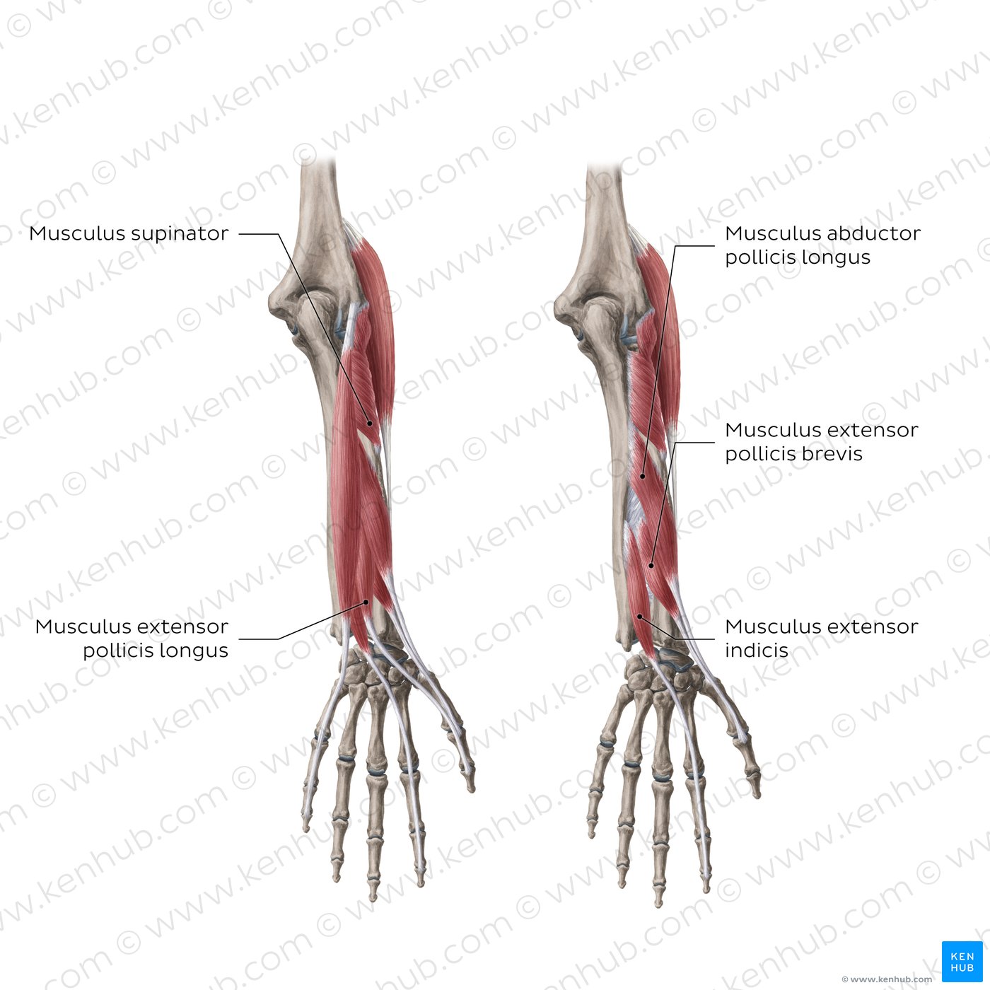Extensoren des Unterarms